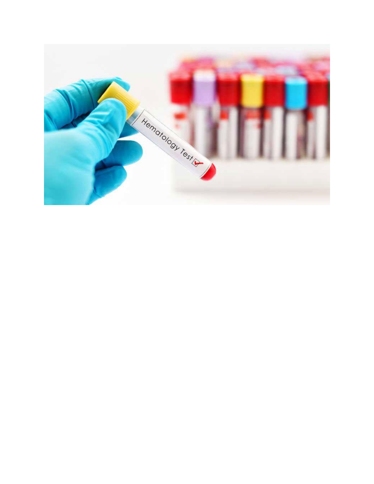 Hematologi